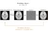 Le problème direct va de l’image vers la mesure _ La reconstruction suit le chemin inverse
