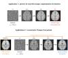 Modèles de diffusion appliqués à l’imagerie médicale_Les deux applications étudiées
